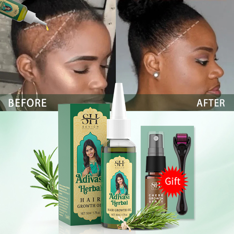 Ayurvedic Hair Growth Oil Indi - Coconut Oil Pull 评论和价格