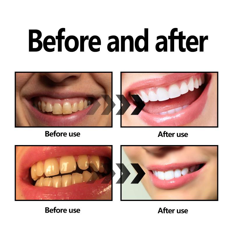 Teeth Whitening Powder Charcoa - Teeth Whitening Charcoal Powder 评论和价格