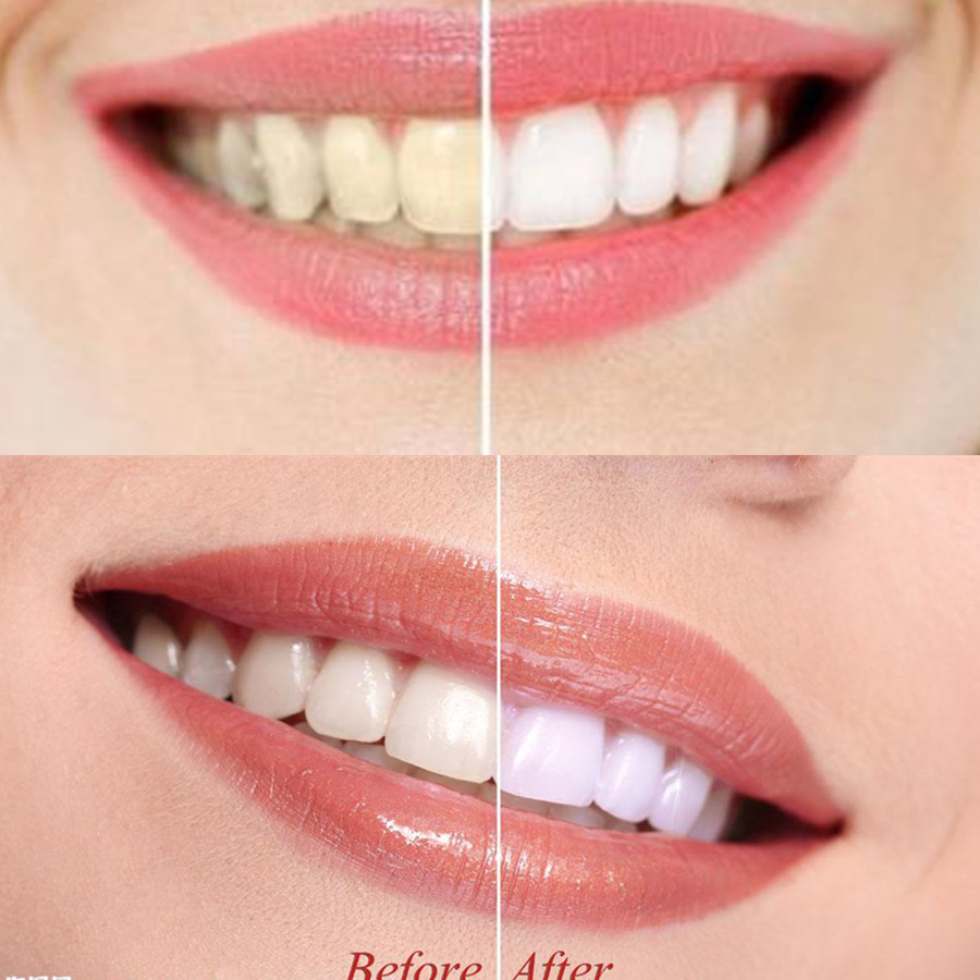 Bamboo Charcoal Teeth Tooth De - Teeth Whitening Charcoal Powder 评论和价格