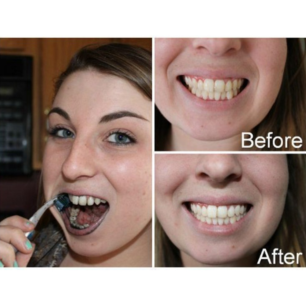 Bamboo Charcoal Teeth Tooth De - Teeth Whitening Charcoal Powder 评论和价格