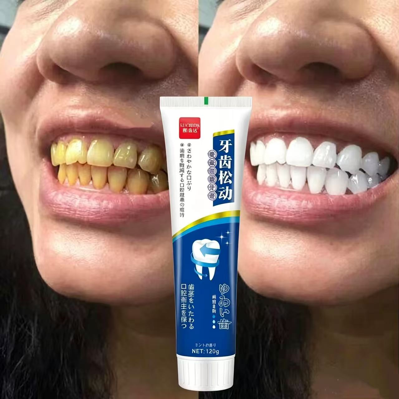 Fix Loose Teeth Japanese Impor - Teeth Whitening Japanese 评论和价格