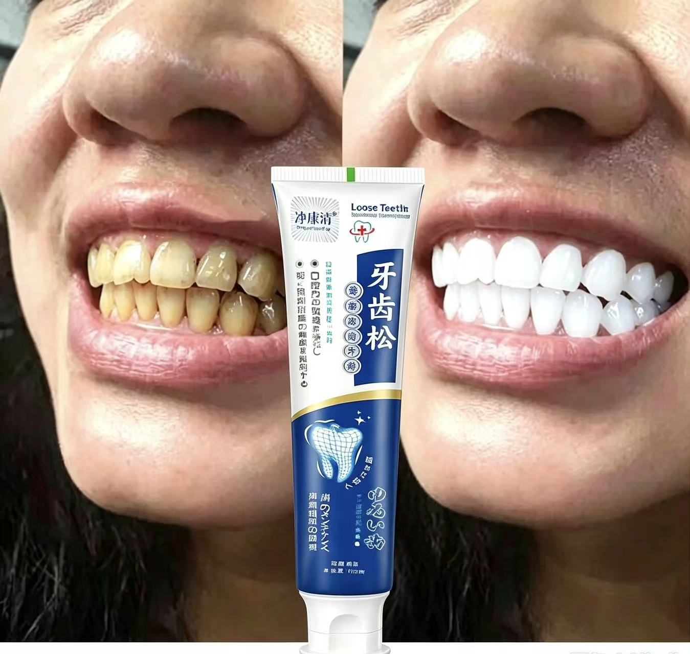 Fix Loose Teeth Japanese Impor - Teeth Whitening Japanese 评论和价格