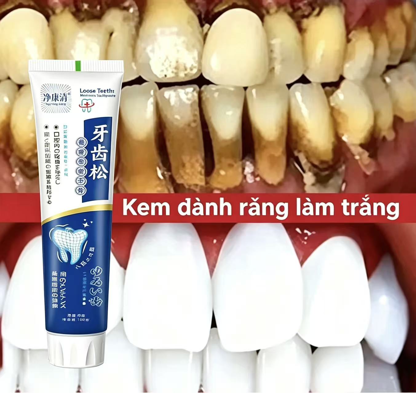 Fix Loose Teeth Japanese Impor - Teeth Whitening Japanese 评论和价格