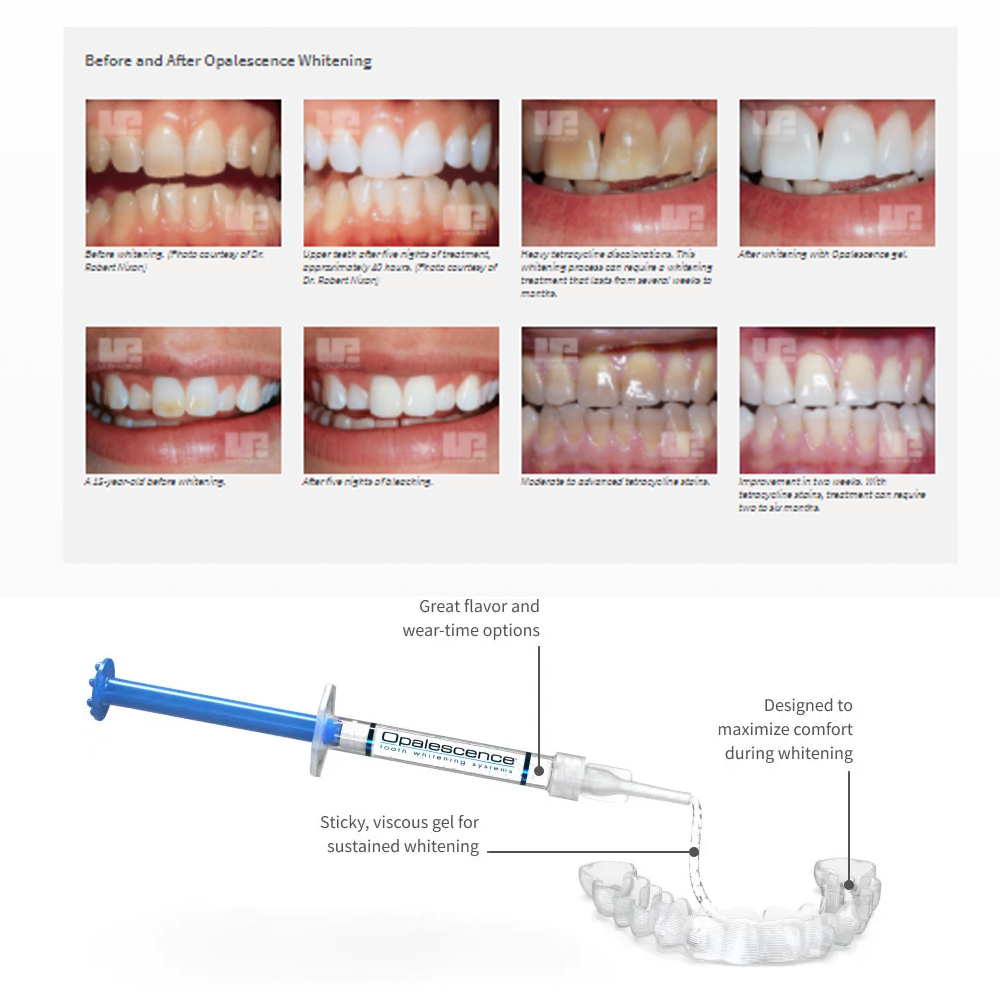 Opalescence Whitening 20% PF 2 - Teeth Whitening Hydrogen Peroxide 评论和价格