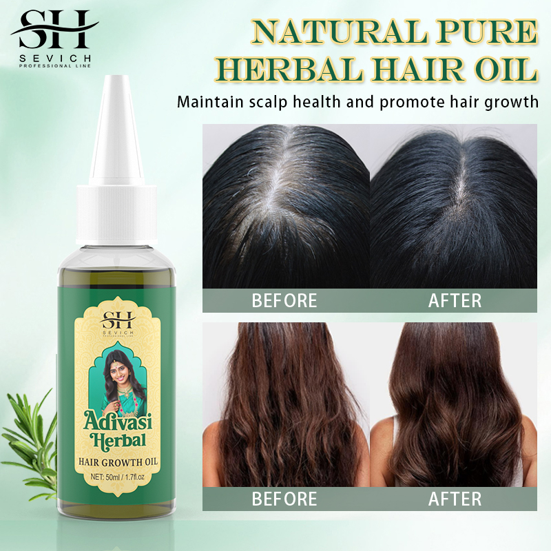 Ayurvedic Hair Growth Oil Adiv - Coconut Oil Pull 评论和价格