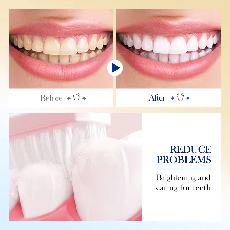 220G/Tube Lactobacillus Whiten - Teeth Whitening Youtube 评论和价格