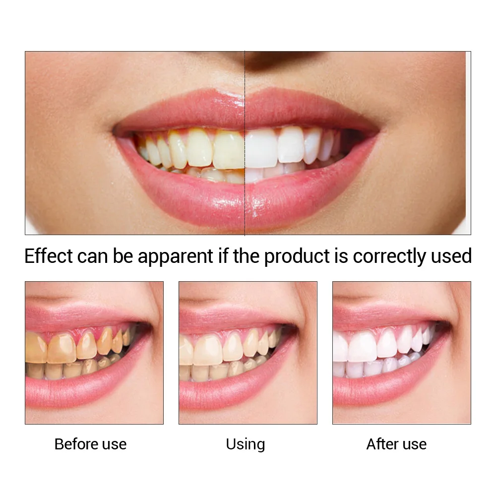 FTEENPLY Teeth Whitening Essen - Teeth Whitening Clinic 评论和价格