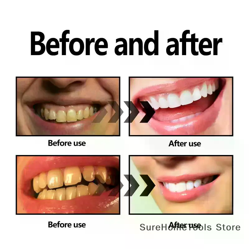Bamboo Charcoal Powder For Tee - Teeth Whitening Charcoal Powder 评论和价格