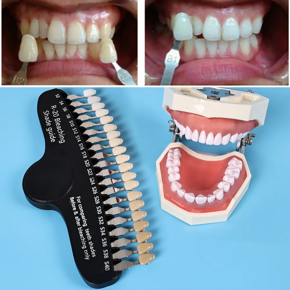 ELIJAH R-20 Bleaching Shade Gu - Teeth Whitening Shade Guide 评论和价格