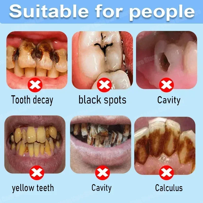 Anti Decay Toothpaste Repairs  - Teeth Whitening Charcoal Powder 评论和价格