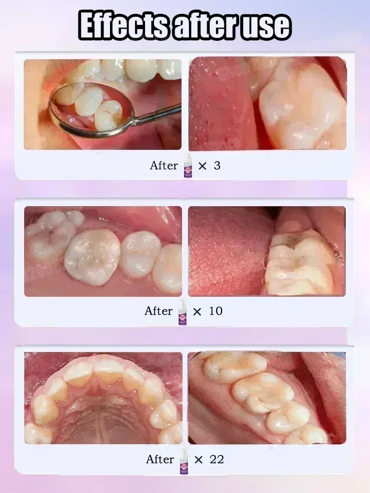 Teeth Cleaning Toothpaste Remo - Teeth Whitening Charcoal Powder 评论和价格
