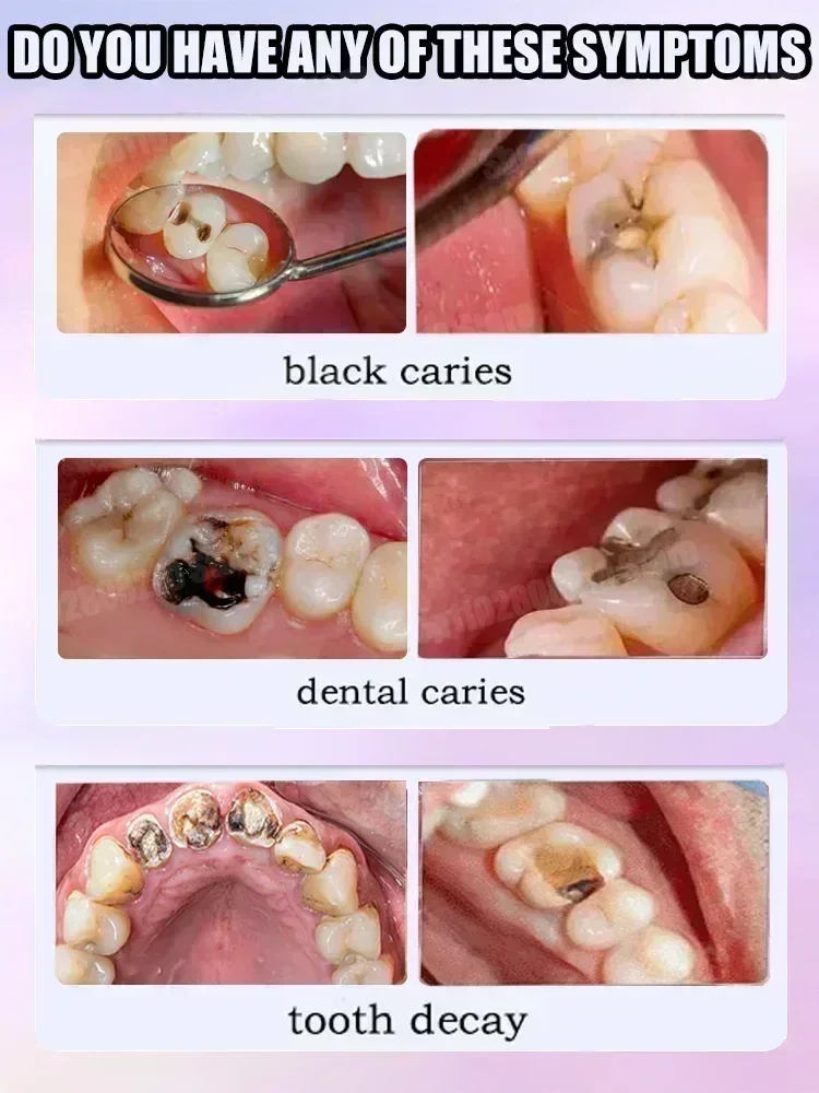 Teeth Cleaning Toothpaste Remo - Teeth Whitening Charcoal Powder 评论和价格